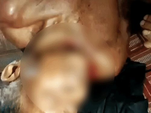 सूरजपुर में 65 वर्षीय बुजुर्ग ने 17 वर्षीय नाबालिग से रेप किया, लड़की ने सब्बल और ब्लेड से हत्या की